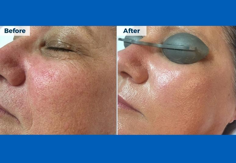 Sunshine Coast Skin Cancer Centre in Sunshine Coast, Queensland